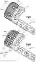 Fig. 05 - Bone fixation system including an implant having a plate portion and a mesh portion