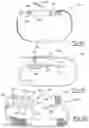 Fig. 54 - Sternal closure method and system