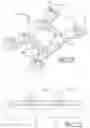 Fig. 93 - Sternal closure method and system