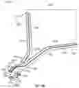 Fig. 94 - Sternal closure method and system