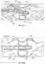 Fig. 96 - Sternal closure method and system