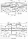 Fig. 97 - Sternal closure method and system