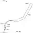 Fig. 98 - Sternal closure method and system