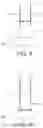 Fig. 08 - Bone graft delivery device for minimally invasive surgery