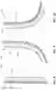 Fig. 07 - Articulating osteotome with cement delivery channel and method of use