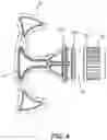 Fig. 05 - Surgical Cable Tensioner