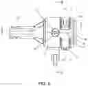 Fig. 06 - Surgical Cable Tensioner