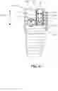 Fig. 07 - Surgical Cable Tensioner