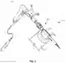 Fig. 02 - Surgical guide and methods of use
