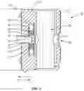 Fig. 06 - Surgical guide and methods of use