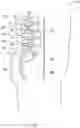 Fig. 02 - Surgical tool