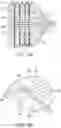 Fig. 08 - Tethered system for cryogenic treatment