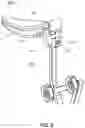 Fig. 06 - Fixation-free robotic surgery