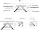Fig. 01 - Interactive display for surgery with mother and daughter video feeds
