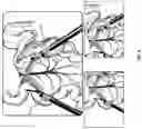 Fig. 09 - Interactive display for surgery with mother and daughter video feeds