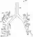 Fig. 01 - Apparatuses and methods for registering a real-time image feed from an imaging device to a steerable catheter