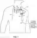Fig. 02 - Apparatuses and methods for registering a real-time image feed from an imaging device to a steerable catheter