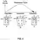 Fig. 05 - Apparatuses and methods for registering a real-time image feed from an imaging device to a steerable catheter