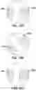 Fig. 21 - Apparatuses and methods for registering a real-time image feed from an imaging device to a steerable catheter