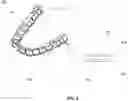Fig. 06 - Laser marking of dental appliances