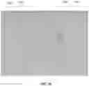Fig. 16 - Laser marking of dental appliances