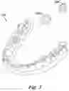 Fig. 04 - Methods of forming patterned dental positioning appliances