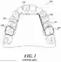 Fig. 02 - Dental arch and airway expander device and method