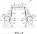 Fig. 03 - Dental arch and airway expander device and method