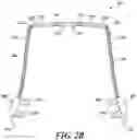 Fig. 04 - Dental arch and airway expander device and method