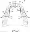 Fig. 07 - Dental arch and airway expander device and method