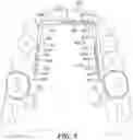 Fig. 15 - Dental arch and airway expander device and method