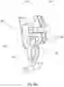 Fig. 37 - Teeth repositioning systems and methods