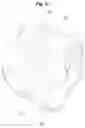 Fig. 09 - Self-ligating orthodontic bracket and opening method thereof