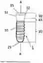 Fig. 02 - DENTAL IMPLANT