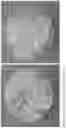 Fig. 07 - DENTAL IMPLANT