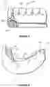 Fig. 05 - Dental framework and prosthesis