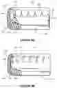 Fig. 06 - Dental framework and prosthesis