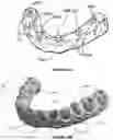 Fig. 07 - Dental framework and prosthesis