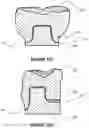 Fig. 15 - Dental framework and prosthesis