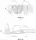 Fig. 22 - Dental framework and prosthesis