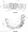 Fig. 23 - Dental framework and prosthesis