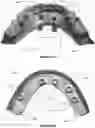 Fig. 25 - Dental framework and prosthesis