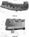 Fig. 26 - Dental framework and prosthesis