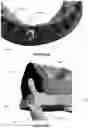 Fig. 28 - Dental framework and prosthesis