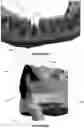 Fig. 29 - Dental framework and prosthesis