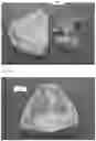 Fig. 03 - Modeling and manufacturing of dentures
