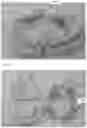 Fig. 04 - Modeling and manufacturing of dentures