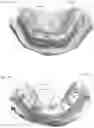 Fig. 07 - Modeling and manufacturing of dentures