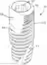 Fig. 01 - Dental implant