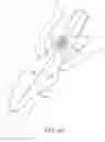 Fig. 08 - Dental implant